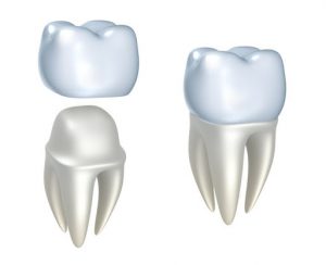 Caring For Your Dental Crowns
