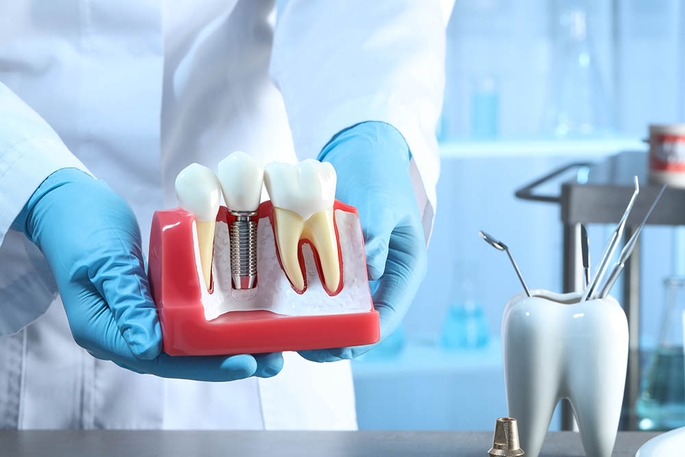 dental implant between teeth indoors
